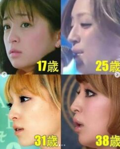 顔が別人になった説は本当か？